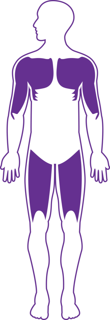 Limb-girdle muscular dystrophy